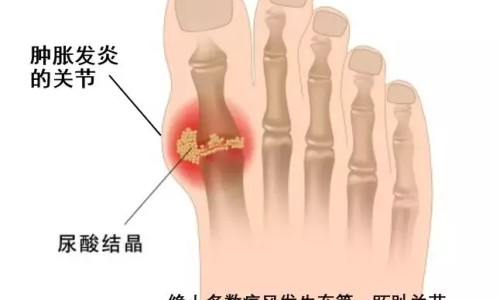 吴茱萸 白醋-【吴茱萸醋炙泡水喝怎么做】醋泡吴茱萸敷脚心的功效 - 醋调吴茱萸作用网